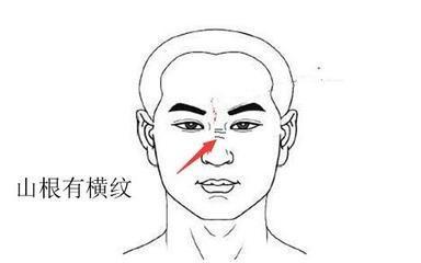 山根断的男人命不好吗 男人山根断是什么意思