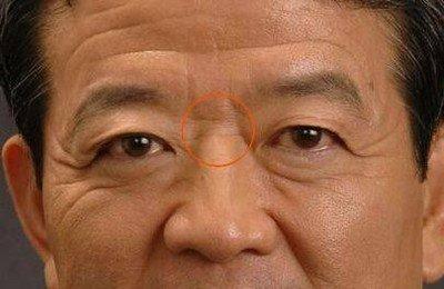 山根断面相图解 山根断的人命运怎么样