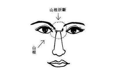 山根断面相都有哪些特殊的含义 山根断的面相好不好 山根断面相都有哪些特殊的含义 山根断的面相好不好