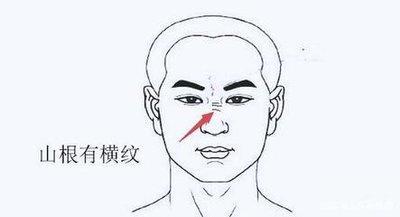 山根有横纹的人命运如何 山根有横纹好不好