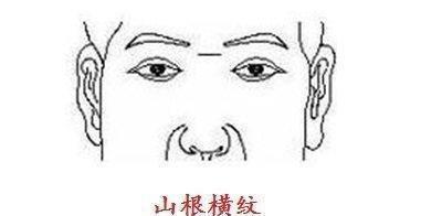 山根有横纹的人命运如何 山根有横纹好不好