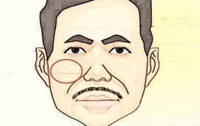 山根有横纹的人命运解析 山根出现横纹好吗