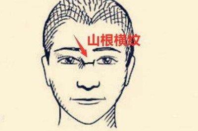 山根有横纹的人命运解析 山根出现横纹有哪些含义