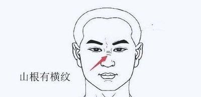 山根有横纹的人是苦命相吗 山根有横纹的人命运怎么样