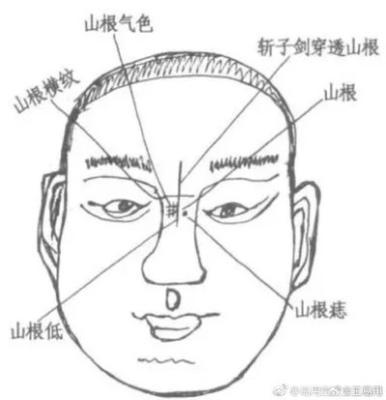 山根有痣代表什么意思 山根有痣的人一生命运怎样