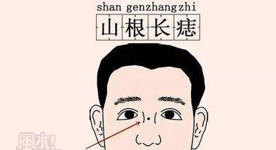 山根有痣代表什么意思 山根长痣的人一生运势