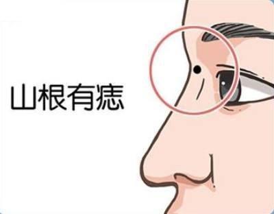 山根有痣的女人一生命运怎么样 女人山根长痣好吗