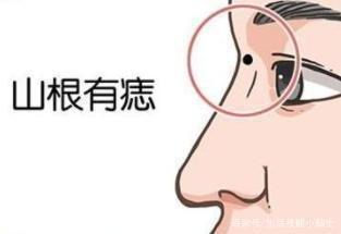 山根有痣的男人命好不好 男人山根长痣有哪些影响