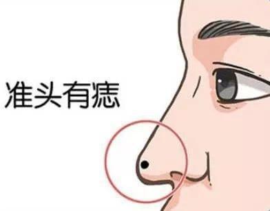 山根有痣的男人命好不好呢 男人山根有痣好吗