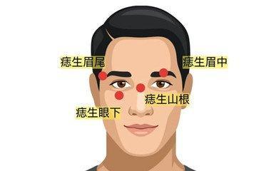 山根有痣的男人命好不好呢 男人山根有痣好吗