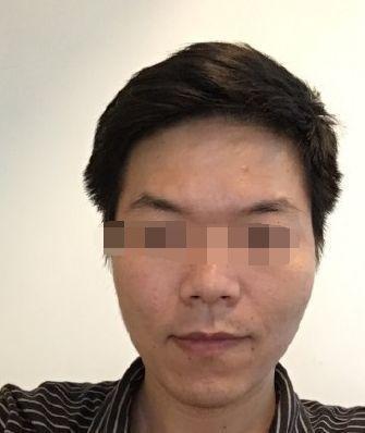 山根高预示了什么 山根高的人婚姻好吗