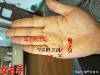 岛纹对人生运势有什么影响必须要知道