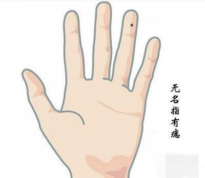 影响自身运势发展 还会刑克身边人的痣相
