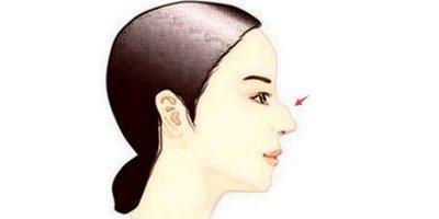 拥有驼峰鼻面相为何会不好 驼峰鼻面相真的不好吗 拥有驼峰鼻面相为何会不好 驼峰鼻面相真的不好吗