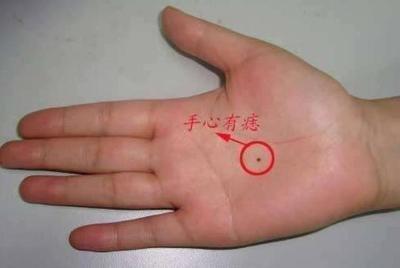 掌心有痣好不好 手相手掌有痣意味着什么