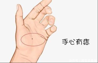 掌心有痣的人运势怎么样 掌心有痣命运详细分析