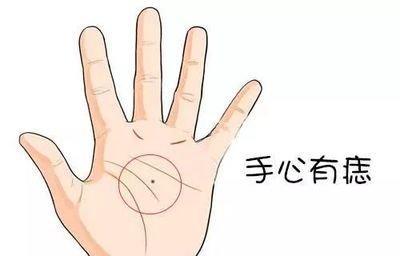 掌心有痣的人运势怎么样 掌心有痣命运详细分析