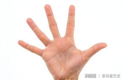 掌心痣代表着什么意义 掌心有痣是好吗