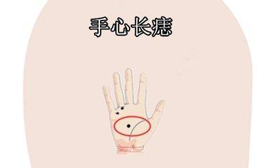 掌心痣的位置与命运分析 手掌心长痣寓意着什么