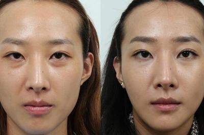 揭秘女人什么样的面相不好克夫克子