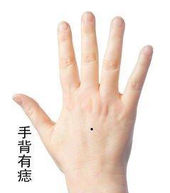 手上不同位置长痣的含义 手上长痣是什么意思
