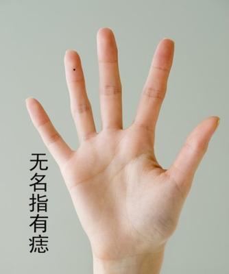 手上哪里长痣好有何寓意 手部这些地方有痣好