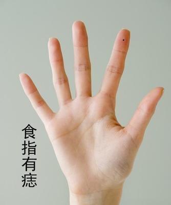 手上有痣代表什么 手上长痣到底是什么意思