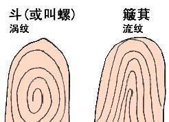 手上这3个地方有痣的人命运如何 看手相痣了解命运
