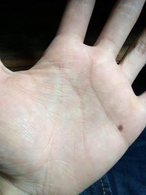手上这3个地方有痣的人命运如何 看手相痣了解命运