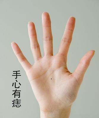 手上长痣图解大全不同位置长痣是什么意思