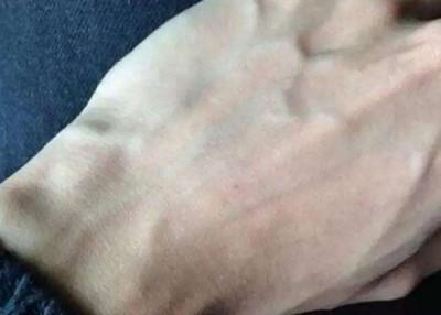 手上青筋多说明什么  手上青筋多的人命运好不好