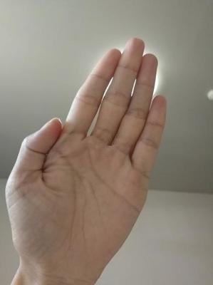 手上青筋看出你的健康状况 手上青筋与健康运势的关系