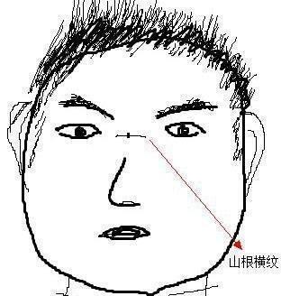 揭秘山根有横纹女人的命运 女人山根有横纹好吗