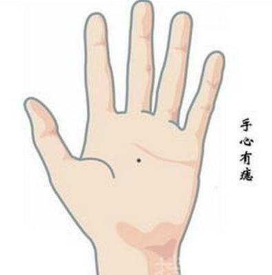手心有痣是好是坏呢 手心长痣说明了什么
