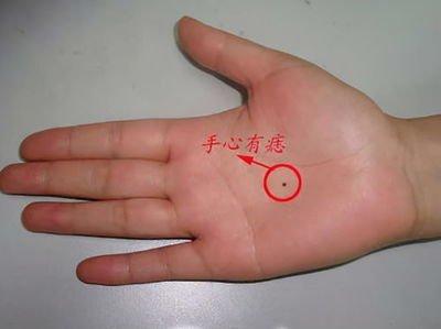 手心有痣的女人命好吗 女人手心长痣意味着什么