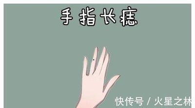 手指上有痣的运势如何 手指长痣好吗