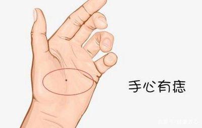 手掌中心有痣好不好 掌心有痣的人运势如何