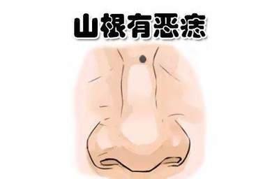 揭秘眉痣对人的运势有何影响真的要知道