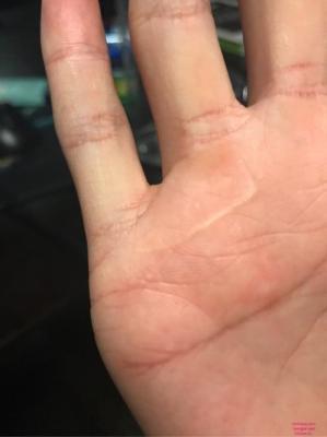 手掌内有伤痕好不好 手掌伤痕是否对手相有影响