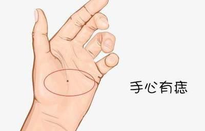手掌心有痣代表什么 掌心有痣好不好
