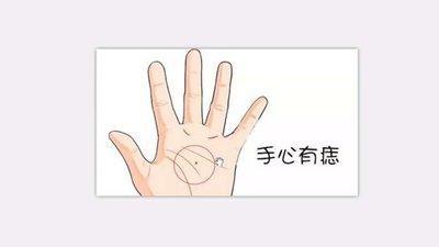 手掌心有痣代表什么 掌心有痣好不好