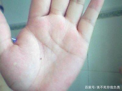 手掌痣的位置与命运解析 手掌心有痣好吗
