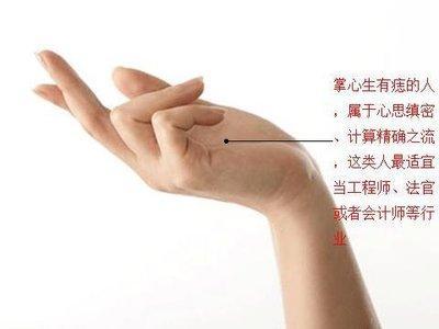 手掌长痣图解 手掌心长痣意味着什么