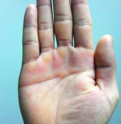 手相中的横财纹命中注定有一笔横财生活无忧 手相中的横财纹命中注定有一笔横财生活无忧