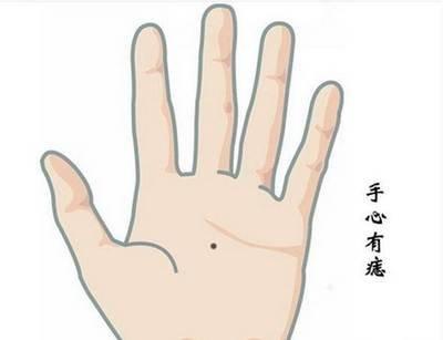 手相分析手掌心有痣的人怎么样命好吗