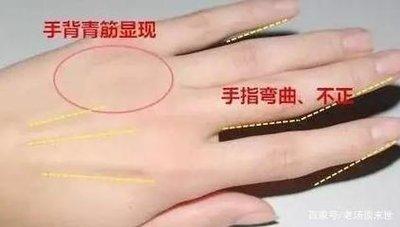 手相小知识之手背青筋突起怎么样有啥影响
