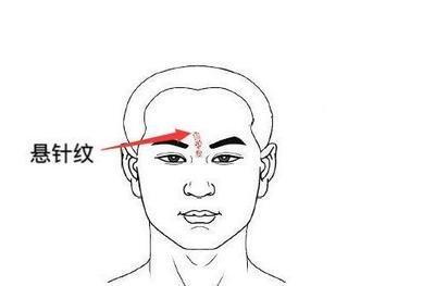 悬针纹会给一个带来什么影响呢 悬针纹的人运势如何
