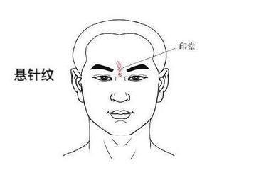 悬针纹会给一个带来什么影响呢 悬针纹的人运势如何