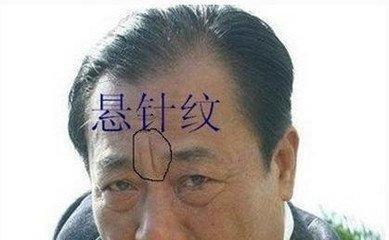 悬针纹对命运的影响有哪些 长有悬针纹真的不好吗 悬针纹对命运的影响有哪些 长有悬针纹真的不好吗