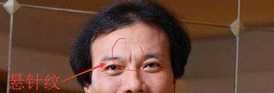 悬针纹男人的面相 男人长有悬针纹好不好